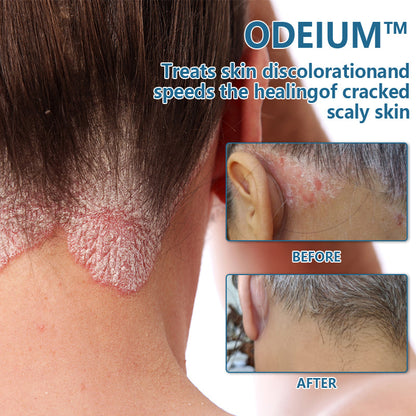 ODEIUM™ Dermatologist skin Bacteriostatic cream